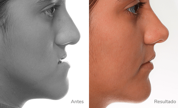 Cirugía-Oral-Maxilofacial